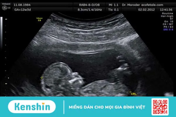 Theo dõi và chăm sóc thai nhi