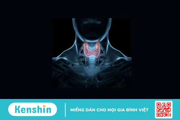 Thiếu Iodine (I-ốt) có gây ra bệnh bướu cổ không?