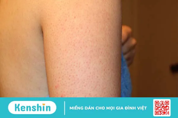 Thiếu vitamin C gây bệnh gì? 16 dấu hiệu thiếu vitamin C, cách bổ sung