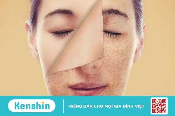 Thiếu vitamin C gây bệnh gì? 16 dấu hiệu thiếu vitamin C, cách bổ sung