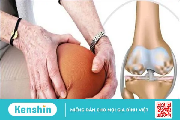 Thiếu vitamin C gây bệnh gì? 16 dấu hiệu thiếu vitamin C, cách bổ sung