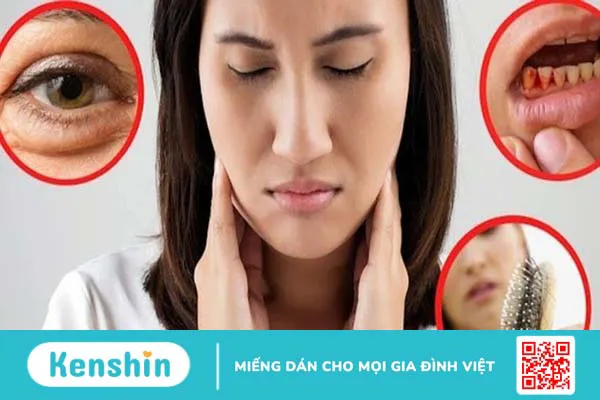 Thiếu vitamin C gây bệnh gì? 16 dấu hiệu thiếu vitamin C, cách bổ sung