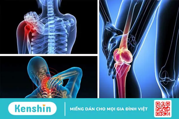 Thổ phục linh (củ khúc khắc) có tác dụng gì đối với sức khỏe?