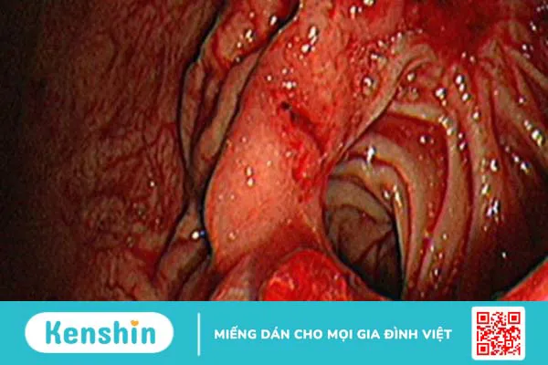 Thói quen không ăn sáng bị gì? 9 tác hại khôn lường không thể bỏ qua