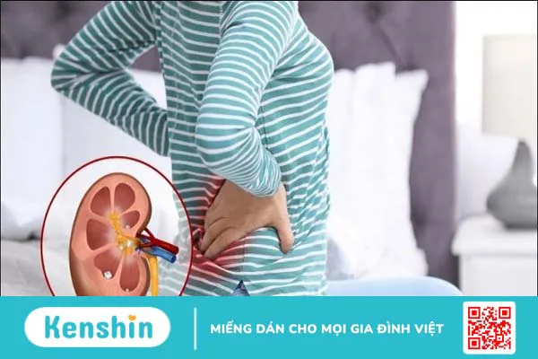 Thừa vitamin C gây bệnh gì? 6 dấu hiệu nhận biết khi thừa vitamin C