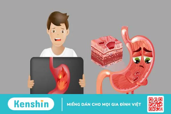 Thừa vitamin C gây bệnh gì? 6 dấu hiệu nhận biết khi thừa vitamin C