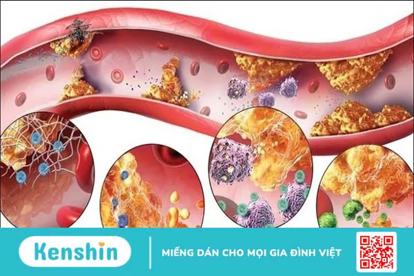 Thuốc ARV có mấy loại? 10 loại thuốc ARV điều trị HIV hiện nay