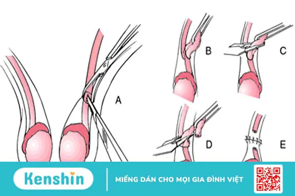 Thuốc tránh thai cho nam có hiệu quả và đâu là cách tránh thai tốt nhất