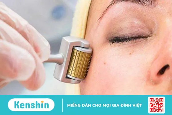 Thủy đậu có để lại sẹo không? 21 cách trị sẹo thủy đậu hiệu quả