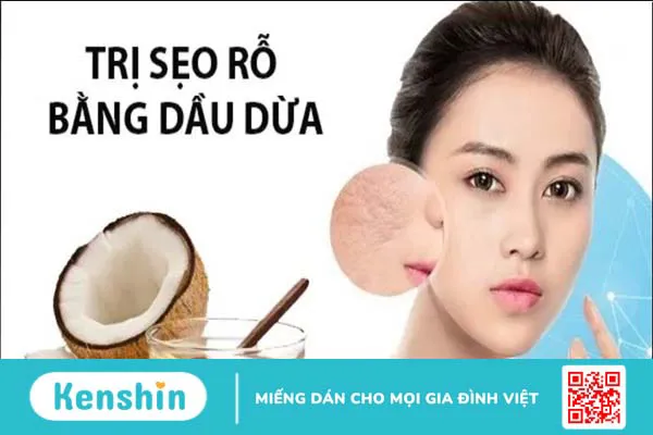 Thủy đậu có để lại sẹo không? 21 cách trị sẹo thủy đậu hiệu quả