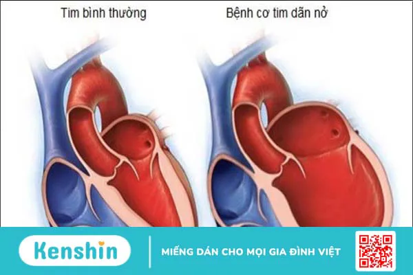 Thymomodulin là gì? Vai trò của Thymomodulin đối với sức khỏe