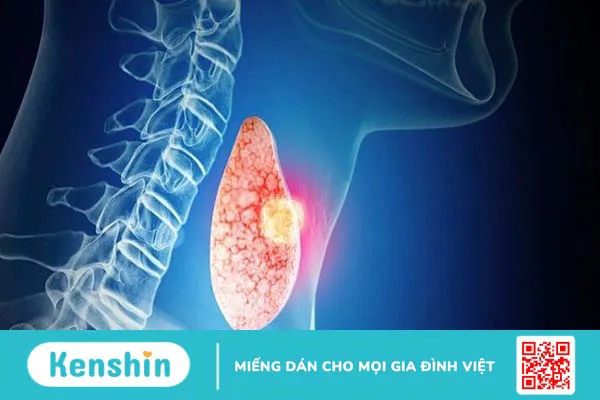 Tim đập nhanh có nguy hiểm không? 3 biến chứng và cách phòng ngừa