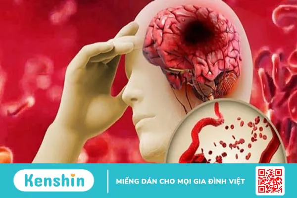 Tim đập nhanh có nguy hiểm không? 3 biến chứng và cách phòng ngừa