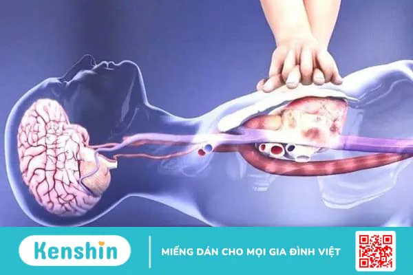 Tim đập nhanh có nguy hiểm không? 3 biến chứng và cách phòng ngừa