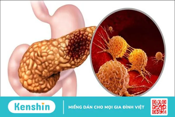 Tìm hiểu 10 nguyên nhân hạ canxi máu phổ biến không thể chủ quan