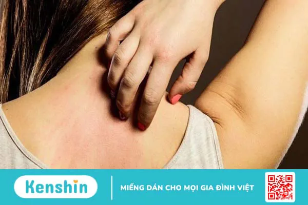 Tinh dầu bạc hà là gì? 17 Tác dụng, cách dùng, tác dụng phụ