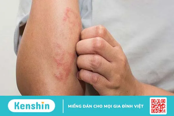 Tinh dầu đinh hương là gì? 8 tác dụng của tinh dầu đinh hương