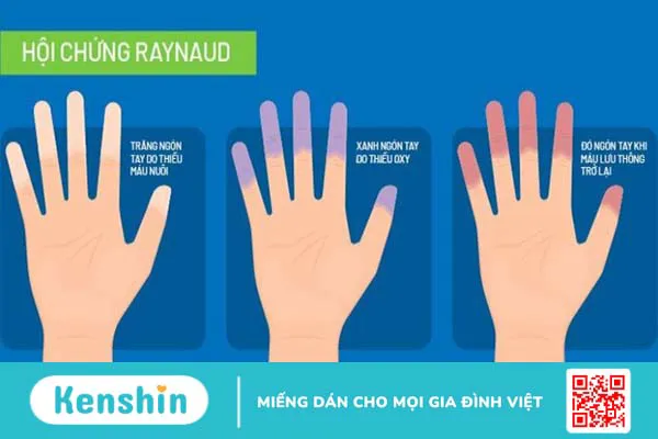 Tinh dầu hoa anh thảo là gì? 10 tác dụng, cách dùng và lưu ý khi sử dụng