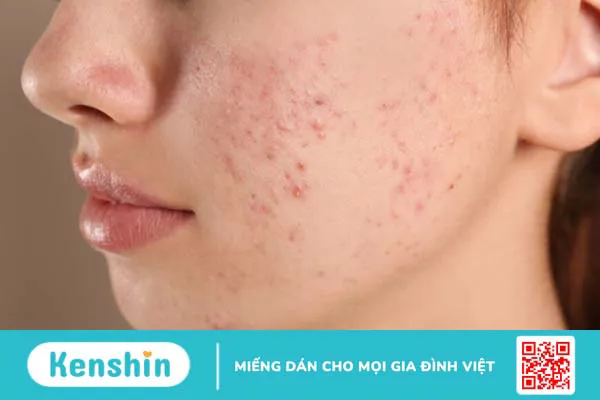 Tinh dầu hoa oải hương (lavender) có tác dụng gì? Xem ngay 12 lợi ích sau