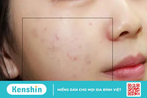 Tinh dầu hoa oải hương (lavender) có tác dụng gì? Xem ngay 12 lợi ích sau