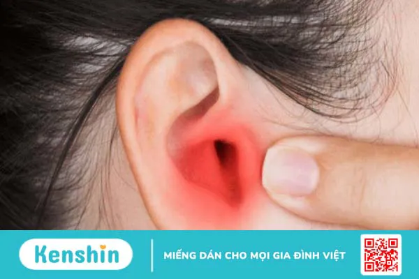 Tinh dầu khuynh diệp có tác dụng gì? 14 công dụng và lưu ý khi dùng