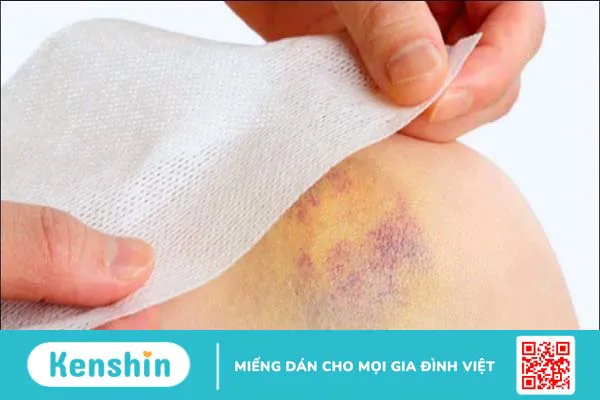 Tinh dầu khuynh diệp có tác dụng gì? 14 công dụng và lưu ý khi dùng