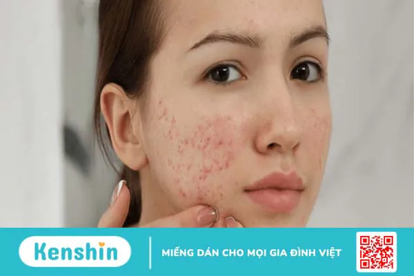 Tinh dầu oải hương có tác dụng gì đối với sức khỏe?