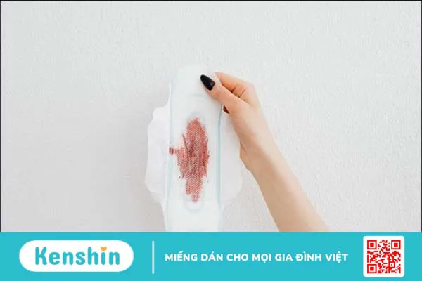 Top 16 băng vệ sinh chống tràn, siêu thấm hút được các chị em tin dùng