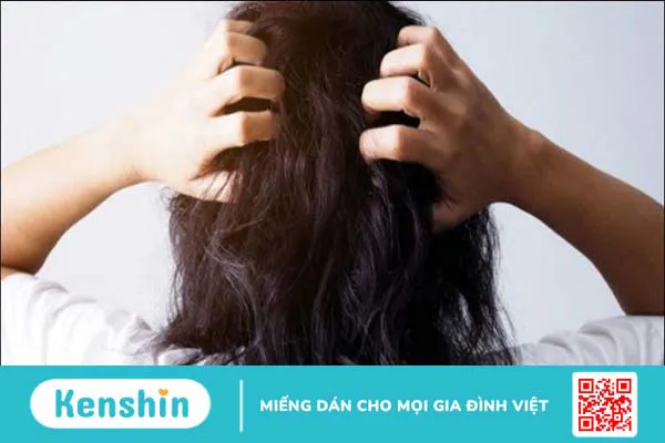 Top 16 loại dầu gội trị gàu, nấm da đầu hiệu quả, nhiều người tin dùng