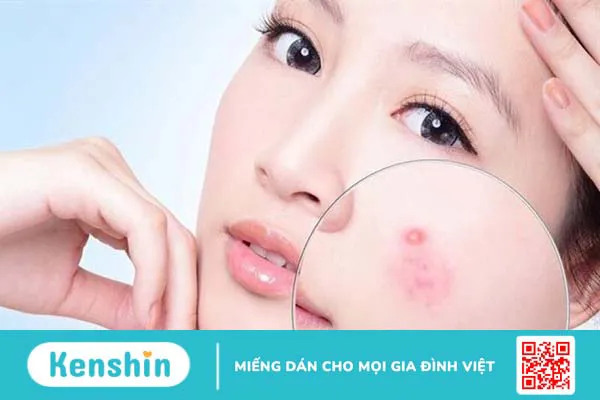 Top 21 loại mặt nạ giấy tốt cho da được các chị em ưa chuộng