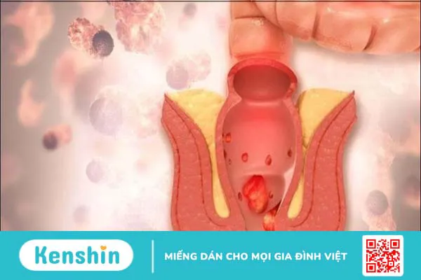 Trà hoa hòe có tác dụng gì? 10 công dụng của hoa hòe với sức khỏe