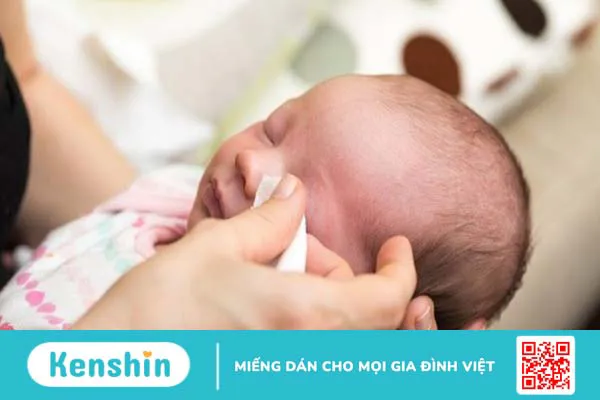 Trẻ bị đau mắt đỏ: Một số lưu ý cha mẹ cần quan tâm!