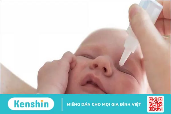 Trẻ sơ sinh bị đau mắt đỏ: Nguyên nhân do đâu và cách xử lý