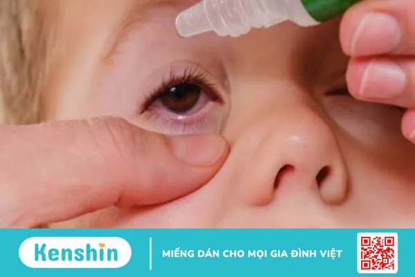 Trẻ sơ sinh bị đau mắt đỏ: Nguyên nhân do đâu và cách xử lý