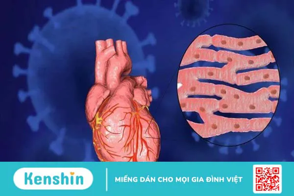 Trẻ sốt siêu vi mấy ngày hết? Cách chăm sóc cho bé mau hết bệnh