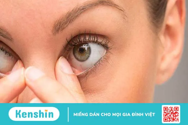 Triệu chứng đau mắt đỏ thường gặp giúp bạn nhận biết bệnh chính xác