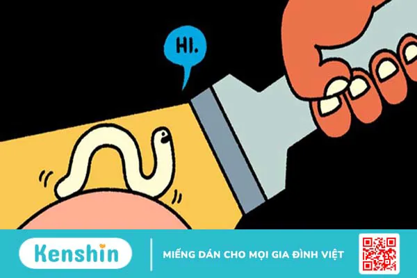 Triệu chứng nhiễm giun bạn cần biết để phát hiện bệnh kịp thời