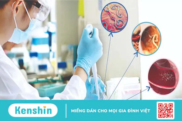 Triệu chứng nhiễm giun bạn cần biết để phát hiện bệnh kịp thời