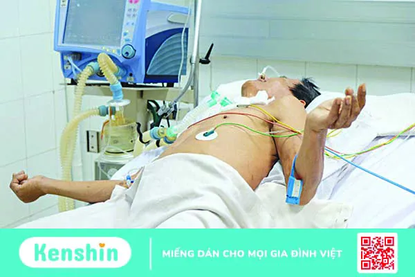 Triệu chứng uốn ván giúp bạn phát hiện bệnh chính xác