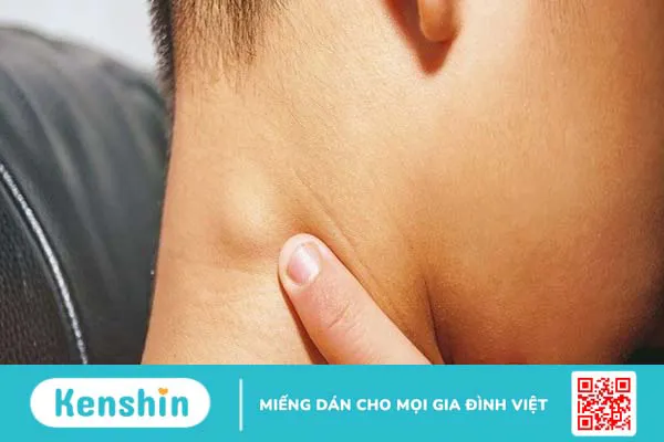 Triệu chứng viêm tai ngoài giúp bạn nhận biết bệnh chính xác