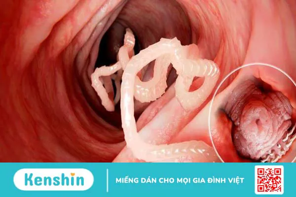 Trinh nữ hoàng cung có tác dụng gì? Công dụng và liều dùng