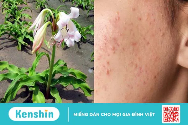 Trinh nữ hoàng cung có tác dụng gì? Công dụng và liều dùng