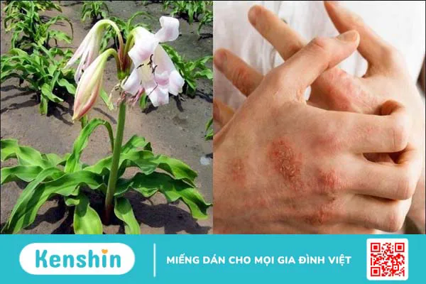 Trinh nữ hoàng cung có tác dụng gì? Công dụng và liều dùng