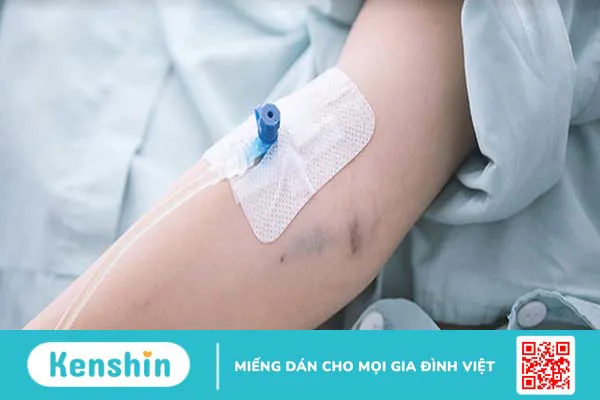 Truyền dịch khi mệt mỏi, nguy cơ tai biến cao