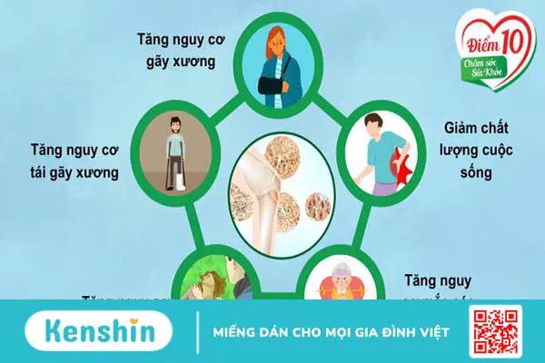 Tuân thủ thời gian điều trị loãng xương: Dù khó khăn nhưng rất cần thiết