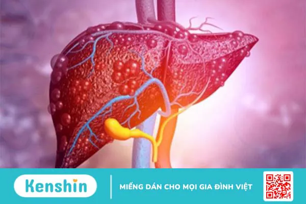 Ứng dụng của natri benzoat trong một số lĩnh vực