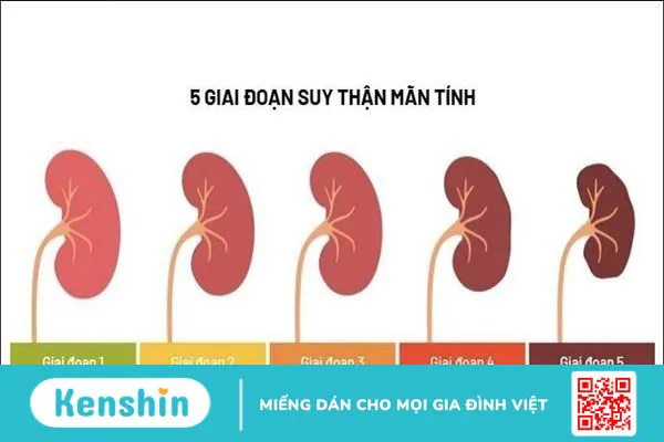 Ứng dụng tiến bộ y khoa trong điều trị và quản lý bệnh thận mạn