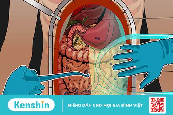 Ung thư dạ dày có chữa được không và các phương pháp điều trị hiện nay