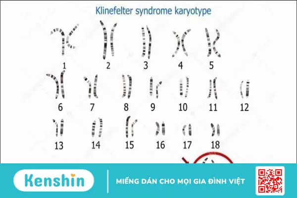 Ung thư máu có di truyền không? 6 dấu hiệu và yếu tố nguy cơ