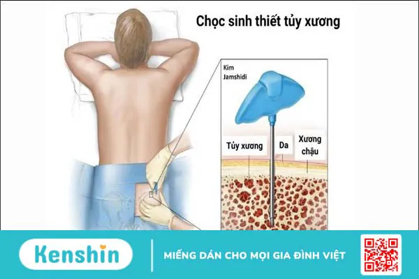 Ung thư máu có di truyền không? 6 dấu hiệu và yếu tố nguy cơ